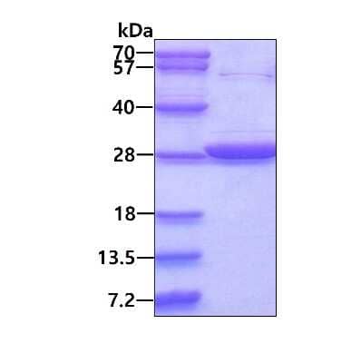 SDS-Page: Recombinant Human GSTT2 His Protein [NBP1-99060] - 3ug by SDS-PAGE under reducing condition and visualized by coomassie blue stain